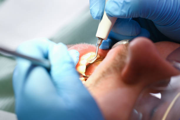 Best Same-Day Emergency Dental Services in Half Moon, NC