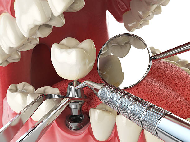 Best Emergency TMJ Treatment in Half Moon, NC