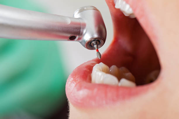 Best Emergency Treatment for Dental Infections or Abscesses in Half Moon, NC
